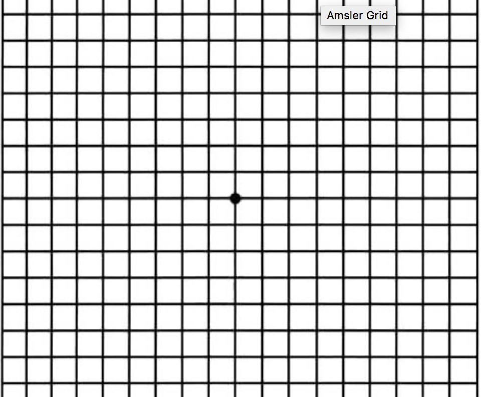 Amsler Grid  Amsler Grid Chart for Eye Test