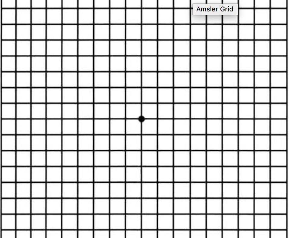 Amsler Grid Test for Retinal Conditions, When to See a Doctor