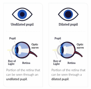 Why We Dilate Your Eyes - Texas Retina Associates